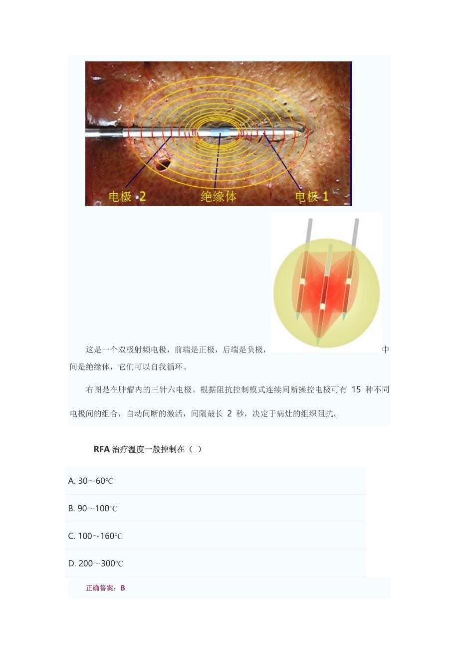 射频消融治疗肺癌的临床应用-郑加生资料_第5页