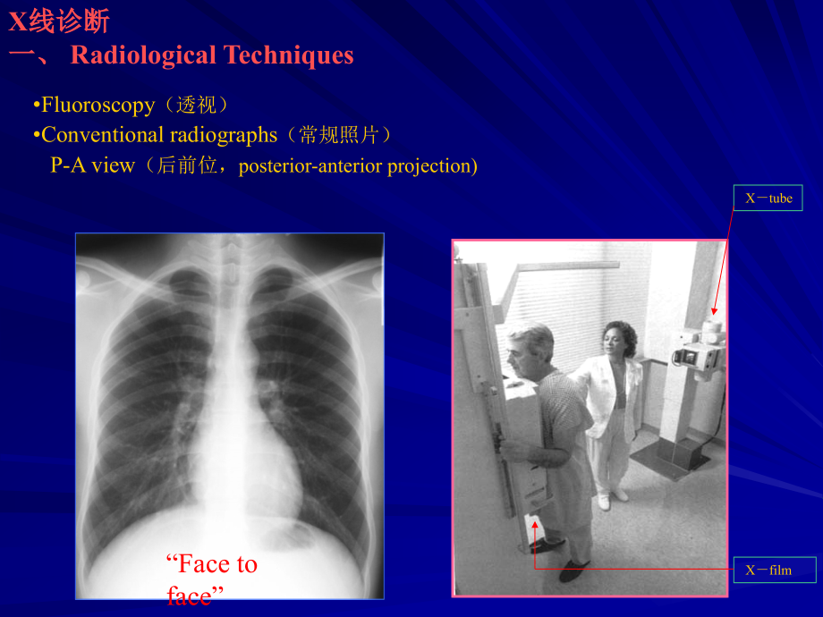 normal chest x-ray recognition of structures(学生讲课)_第3页
