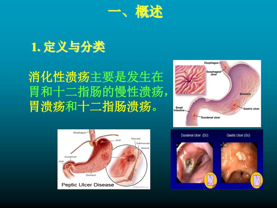 药理学- 抗消化性溃疡药_第2页