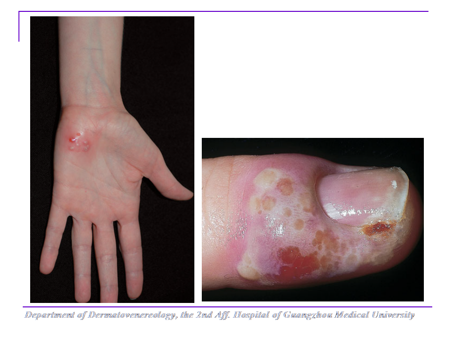 国家基本药物临床应用指南皮肤2014年_第4页