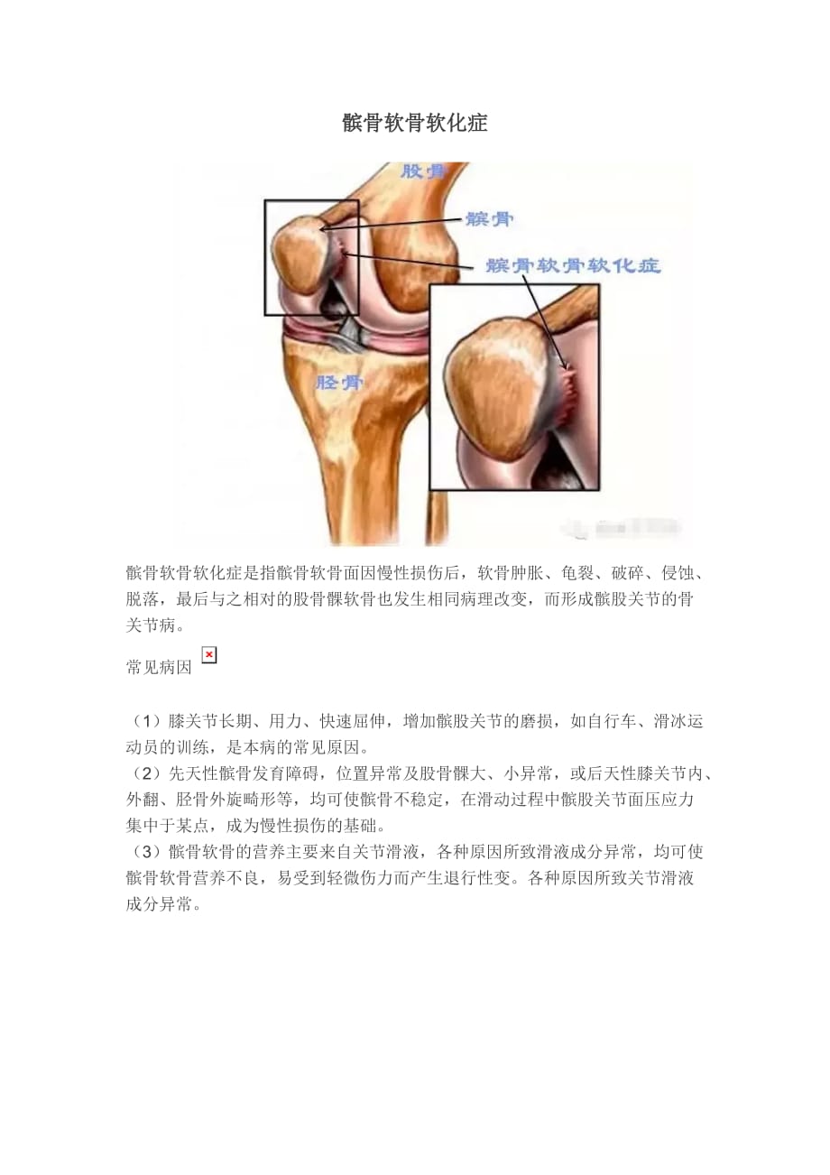 浅谈髌骨软骨软化症.doc_第2页