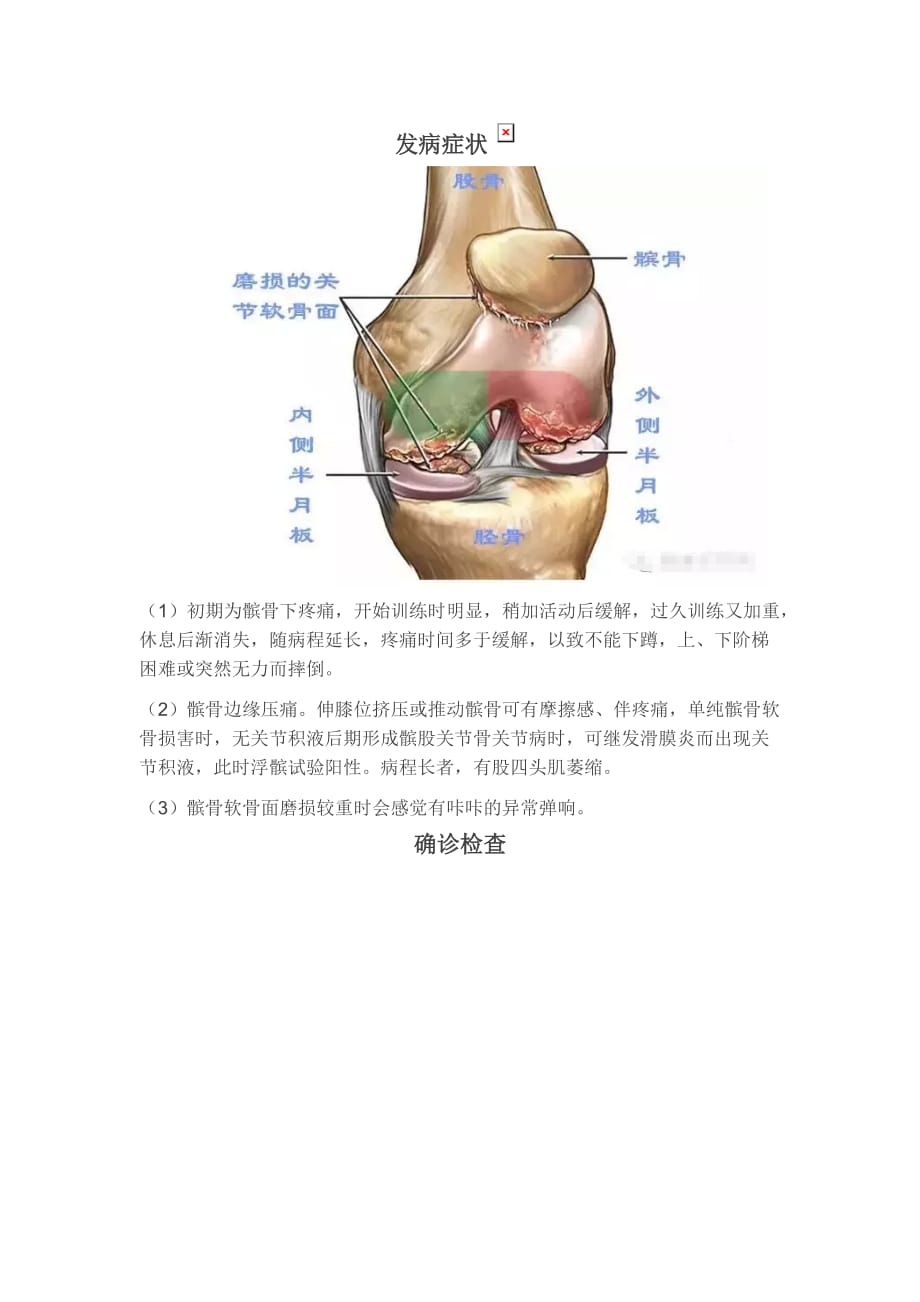 浅谈髌骨软骨软化症.doc_第3页