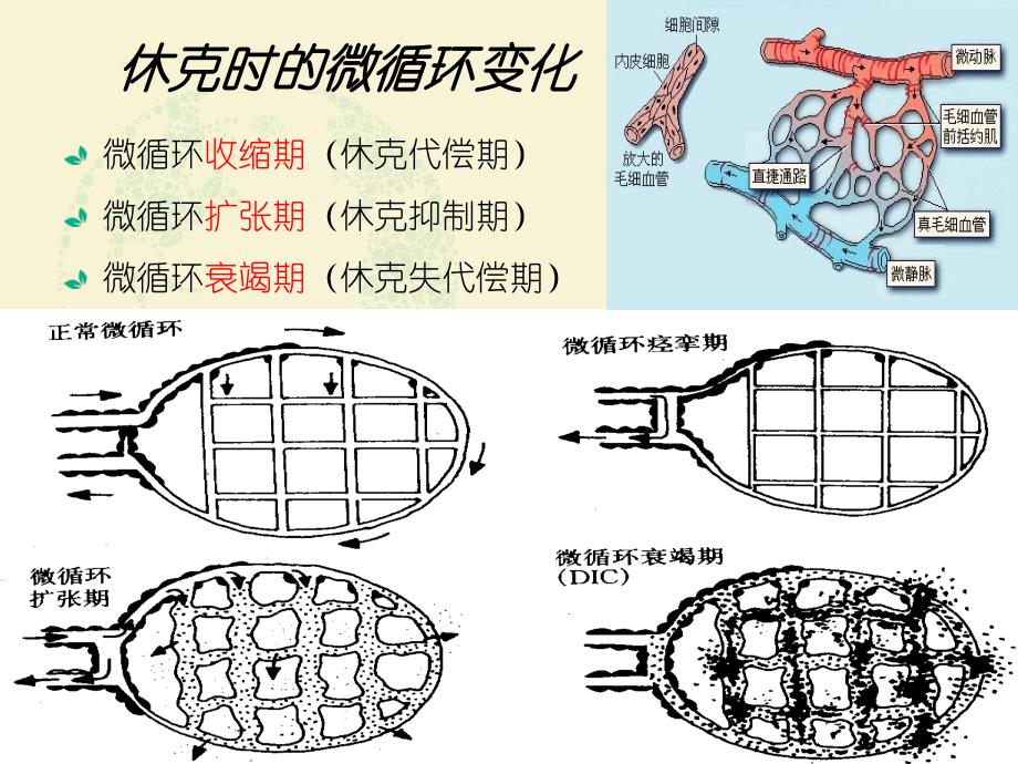 休克病人护理2(1)(1)_第4页