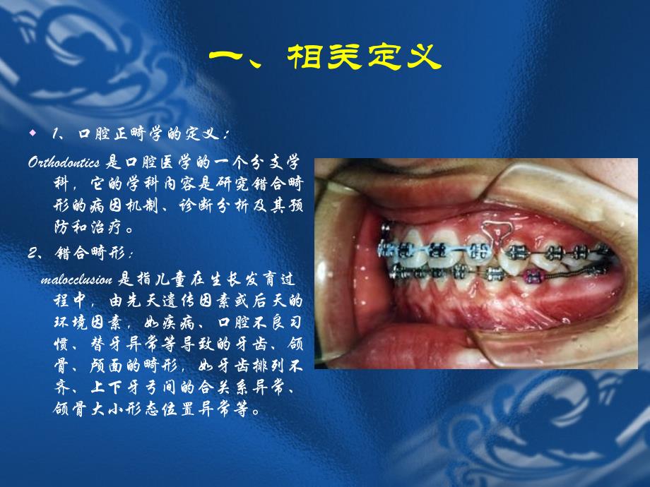 口腔正畸学 第一章绪论_第3页