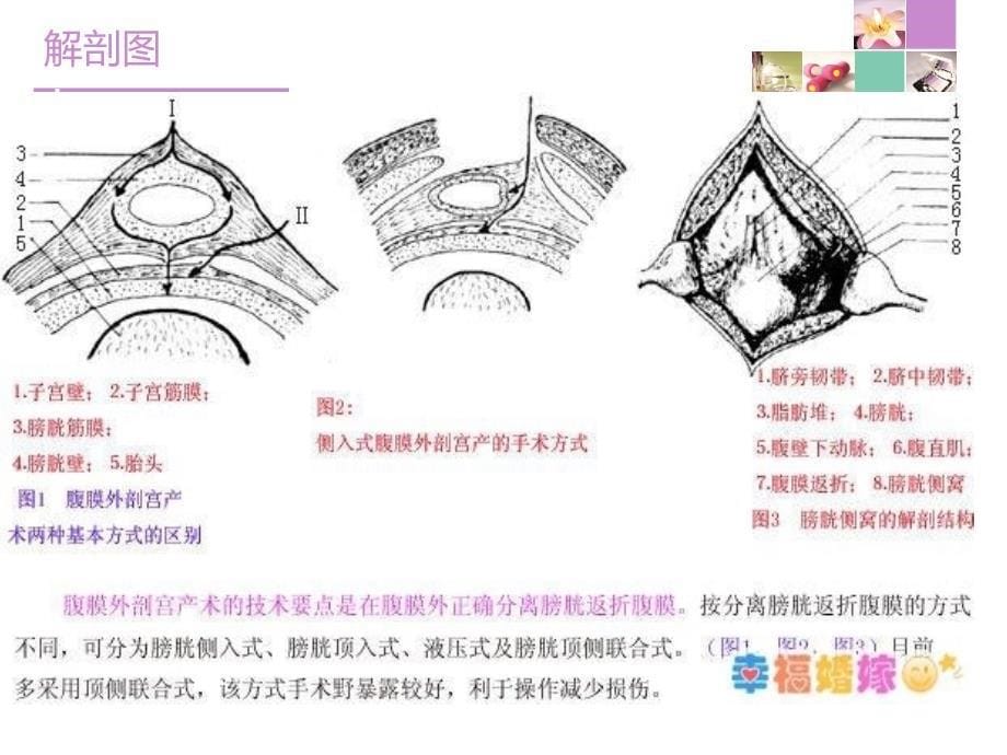 剖宫产术后护理2014年查房_第5页