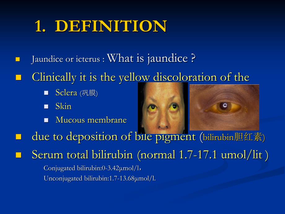 《黄疸》jaundice_第2页