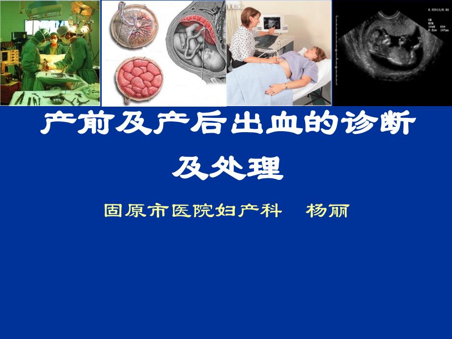 产前与产后出血诊断与处理_第1页