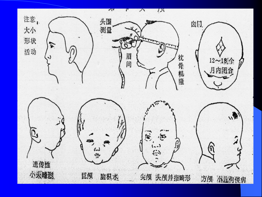 临床医学概要5.6体格检查_第4页