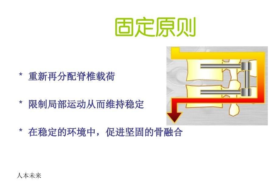 概要脊柱内固定原理概要.._第5页