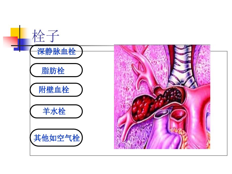 2015-4-3心内二科肺栓塞培训_第4页