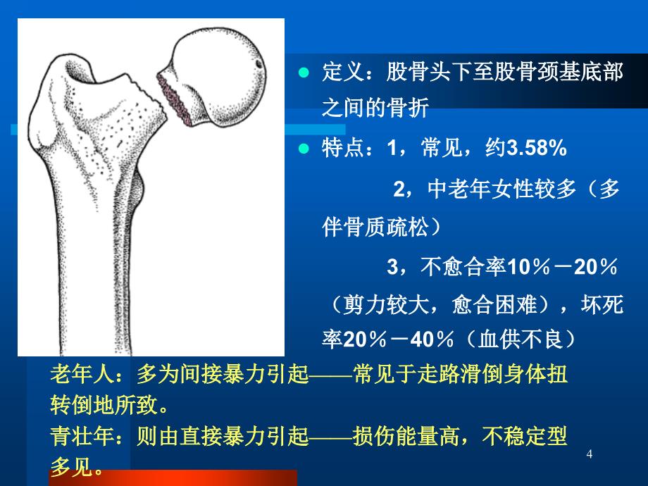 股骨颈骨折全髋关节置换本体感觉缺失康复治疗-精品课件_第4页