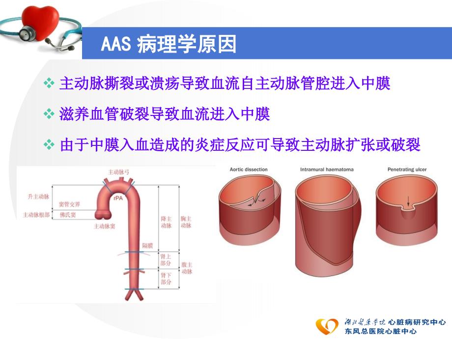 急性主动脉综合征2015年_第3页