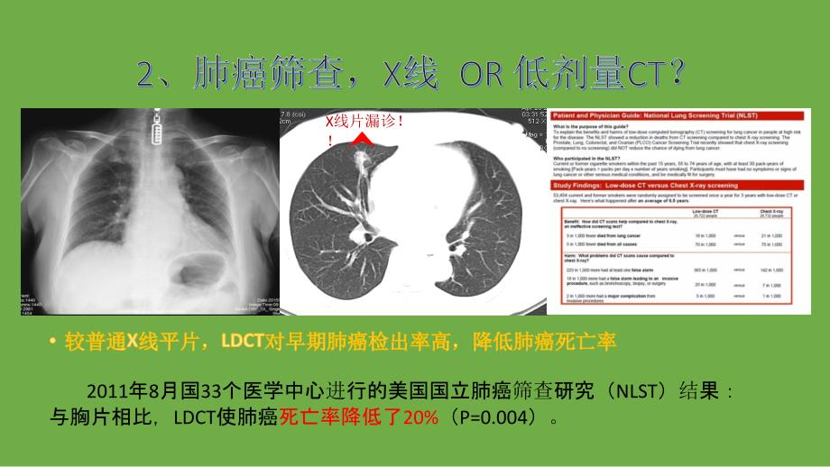 早期肺癌低剂量ct筛查_第4页