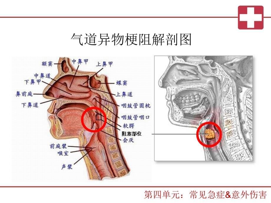 第四单元-常见急症,意外伤害,突发事件救护剖析._第5页