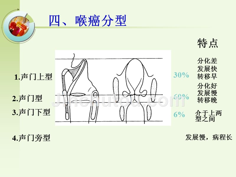 喉癌的护理剖析_第5页