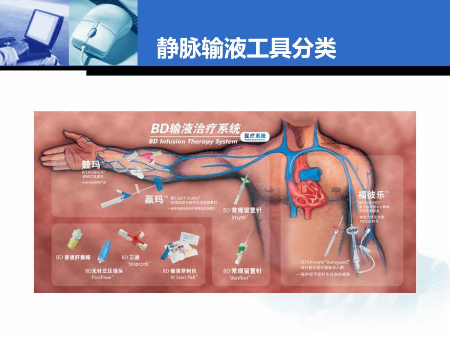 acl导管维护三步曲 2_第4页