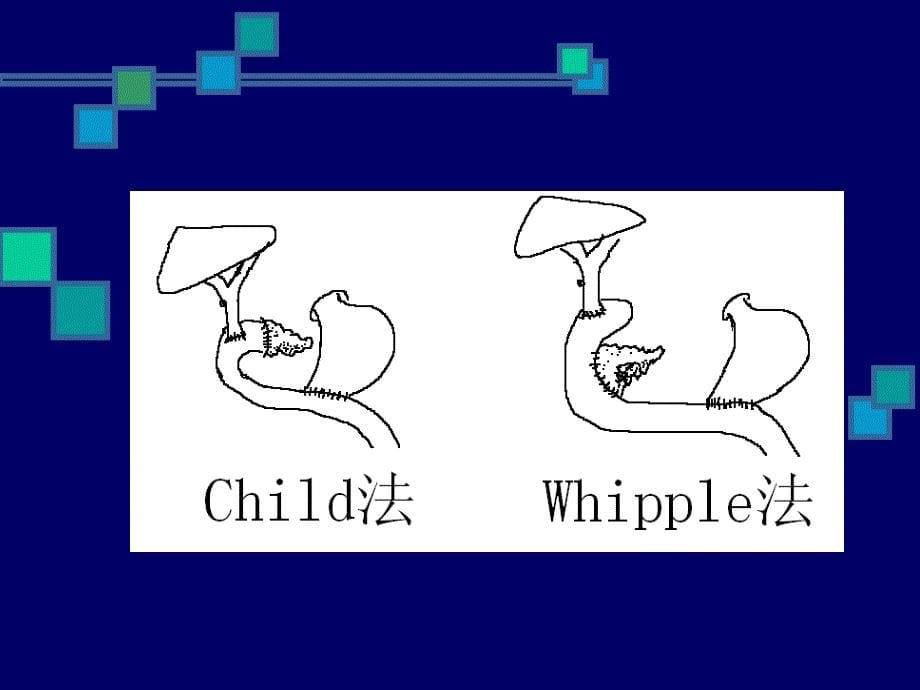 whipple的护理剖析_第5页