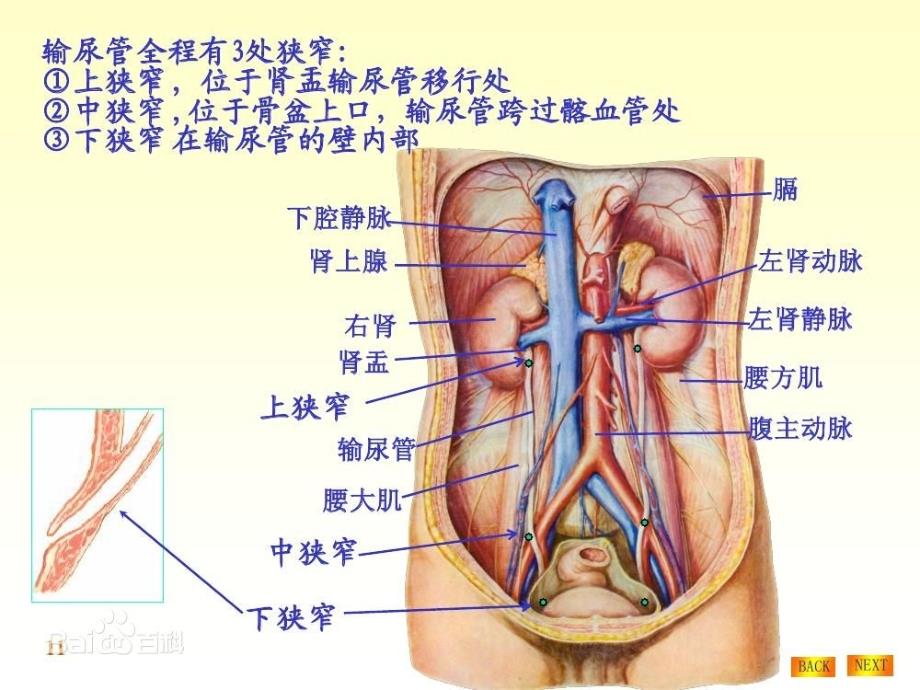 输尿管狭窄段切除与膀胱吻合术 手术配合_第4页