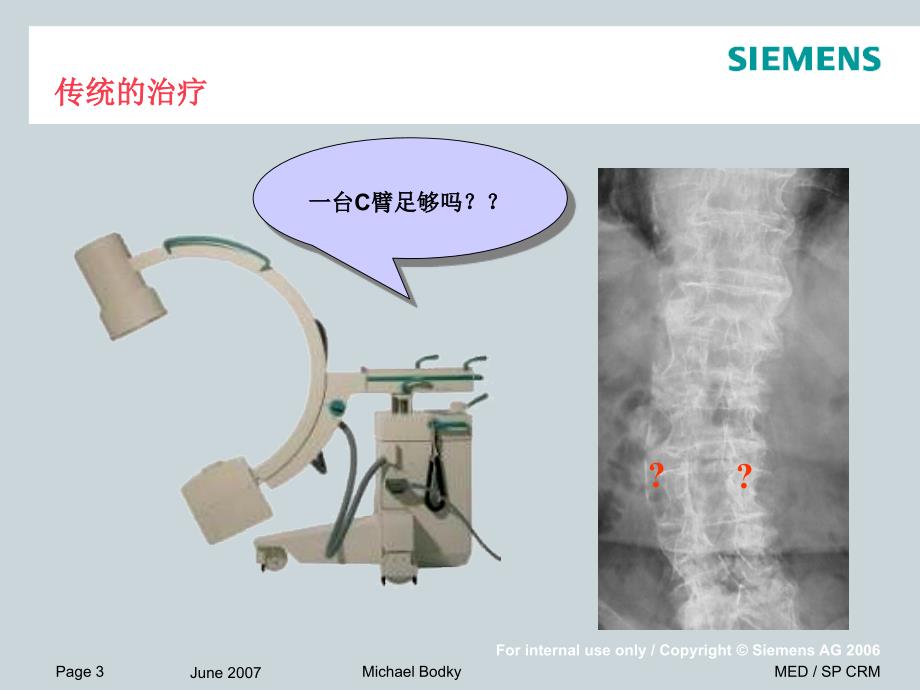 西门子obic-3d在骨科手术中的应用_第3页