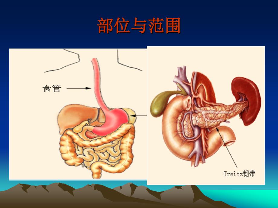 上消化道出血护理 (1)_第4页