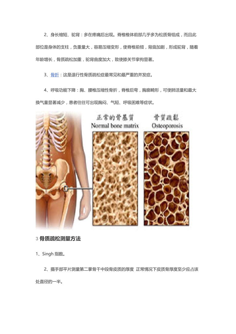 骨质疏松宣传教育_第2页