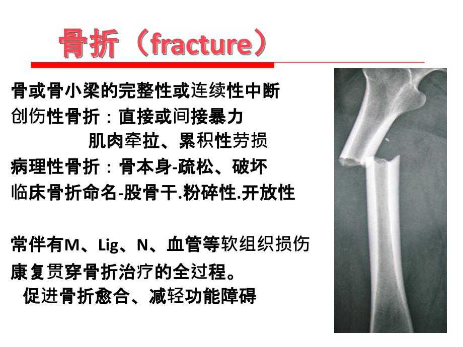 骨折康复总论_第3页