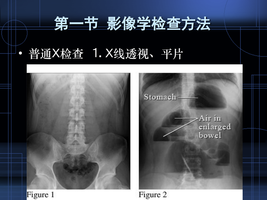 1-3节肝胆胰脾影像诊断_第3页