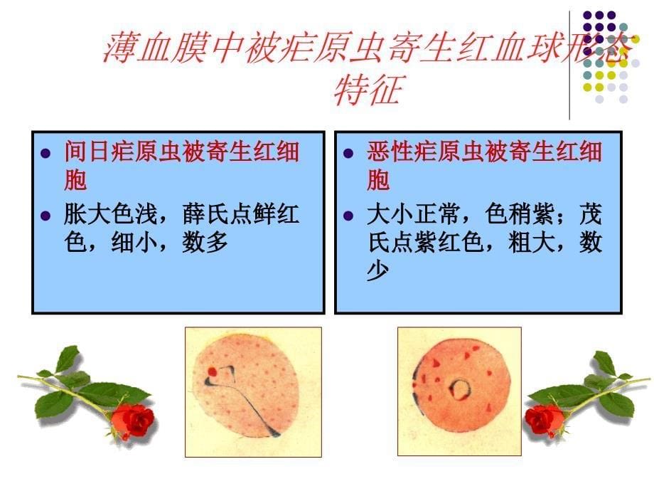 人体疟原虫镜检技术剖析_第5页