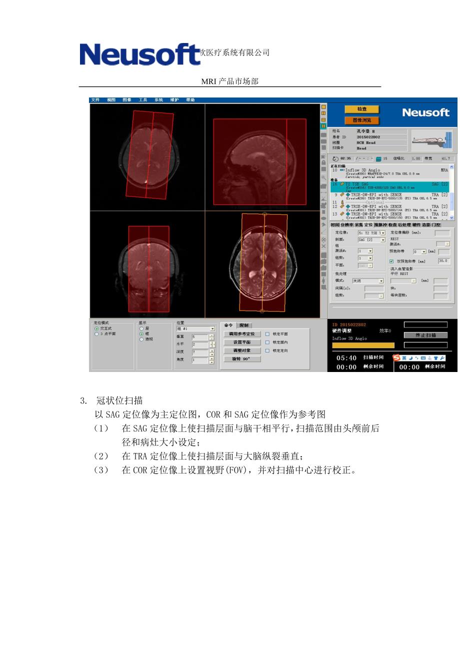 头颅mri扫描规范_第4页