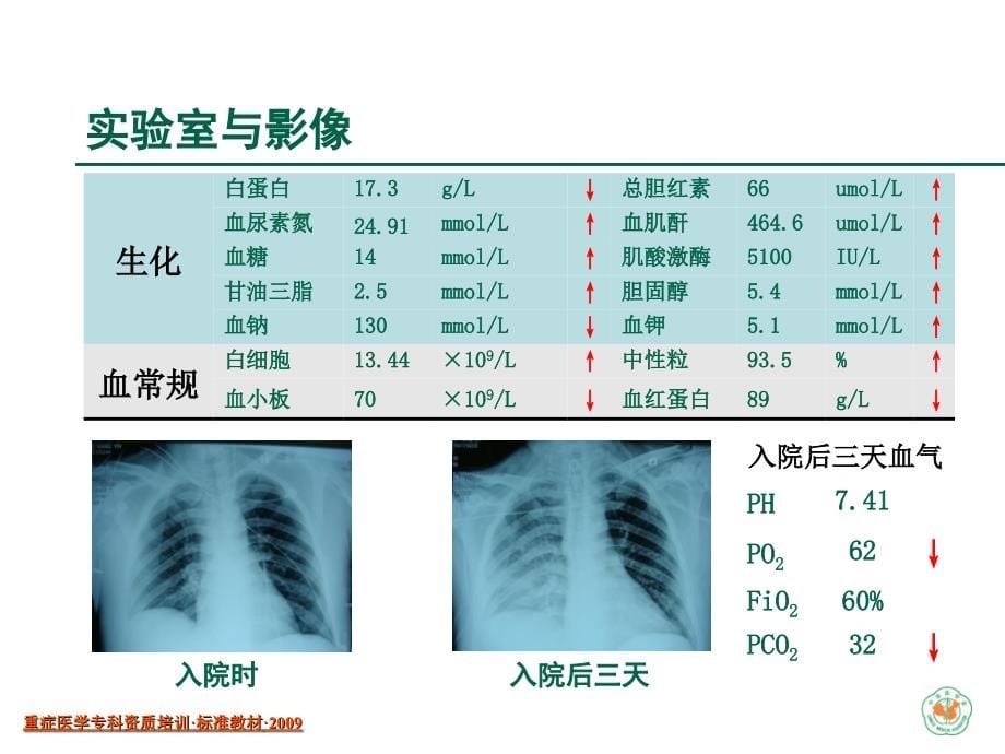 创伤救治-5c培训_第5页