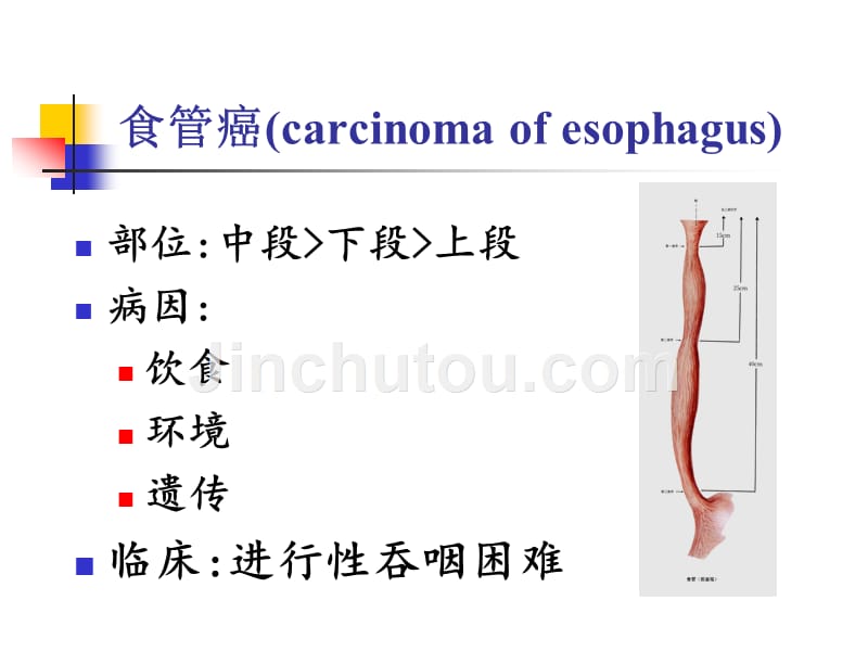 病理学课件-消化系统常见肿瘤_第2页