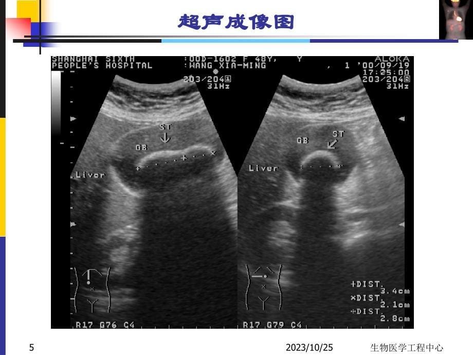 生物医学工程概论之生物医学图像-1-part2_第5页