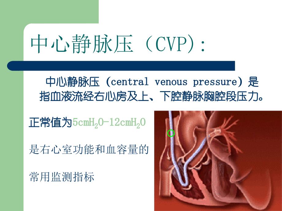 课件：中心静脉压(cvp)监测_第4页