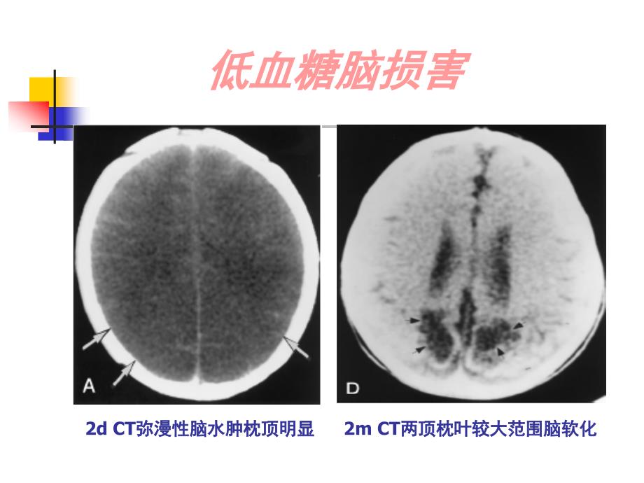 新生儿窒息复苏的热点理念和进展(二)_第3页