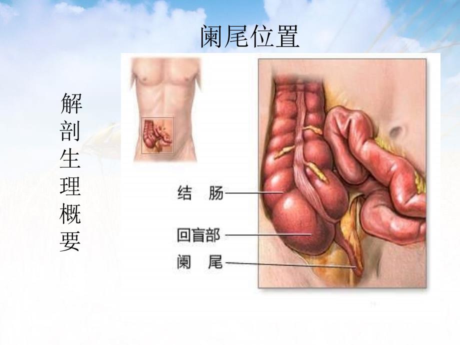 第三十六章阑尾疾病_第2页