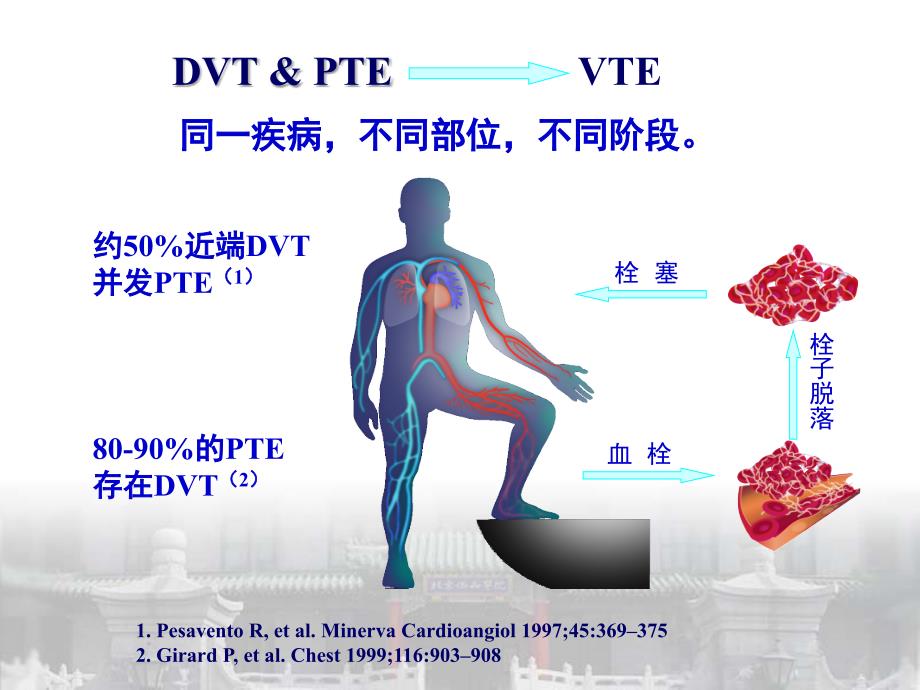 dvt-pte诊断与治疗_第3页