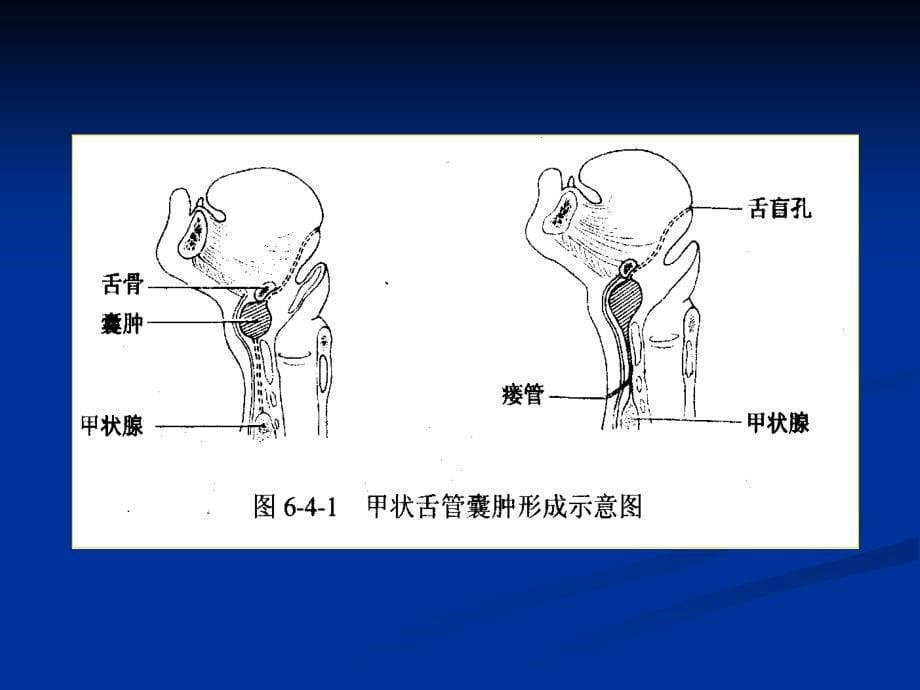 耳鼻咽喉科学七版-颈部科学_第5页