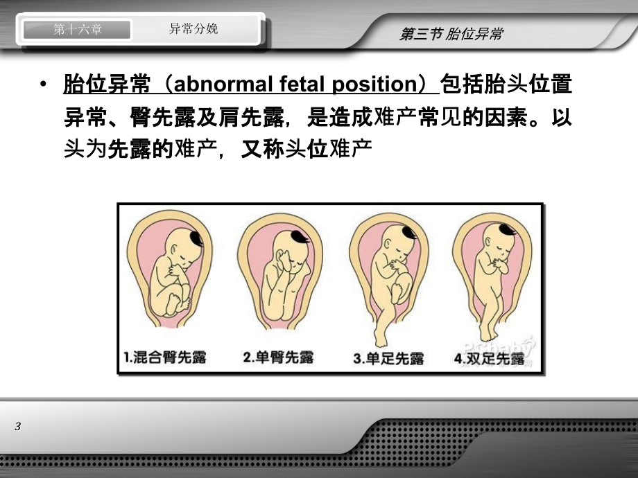 第八版妇产科配套课件-异常分娩-胎位异常_2_第3页