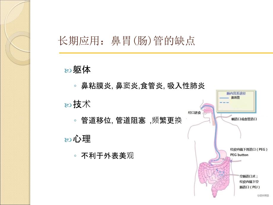 经皮内窥镜引导下胃造口管讲义_第2页