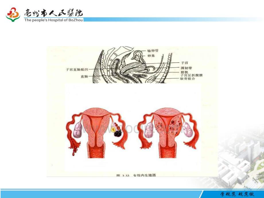 腹腔镜下卵巢囊肿剥除术教学ppt_第3页