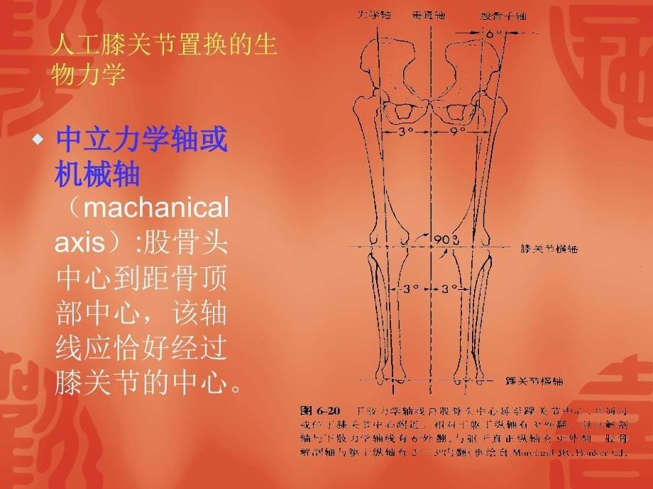 膝关节表面置换术_第5页