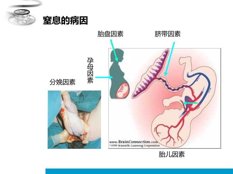 儿科-新生儿窒息规范_第5页