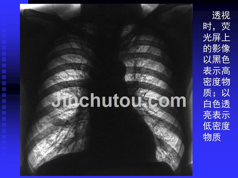 正常胸部影像学ppt_3_第3页