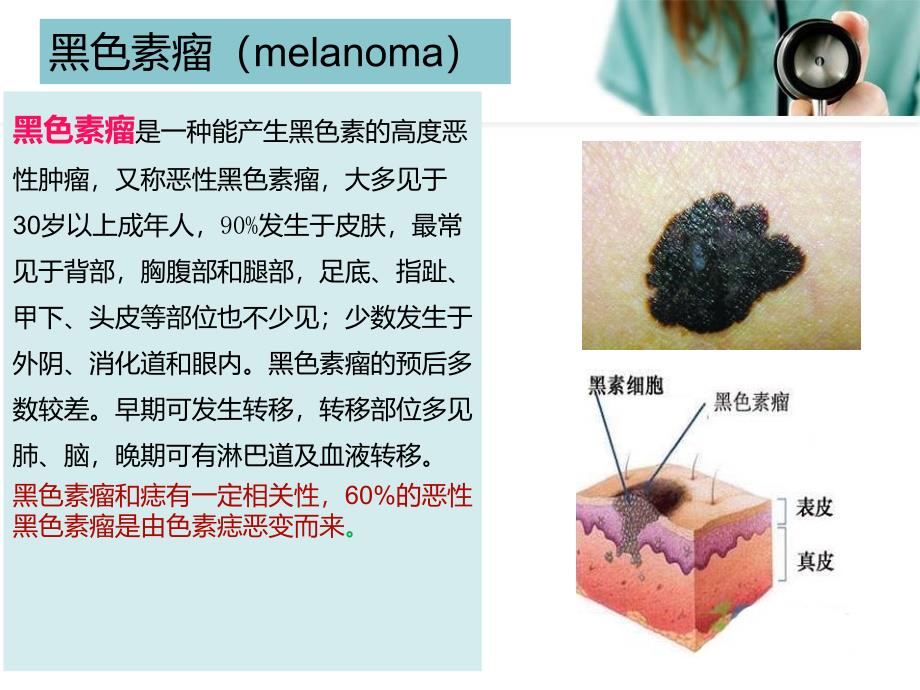 恶性黑色素瘤患者的护理 (1)_第3页