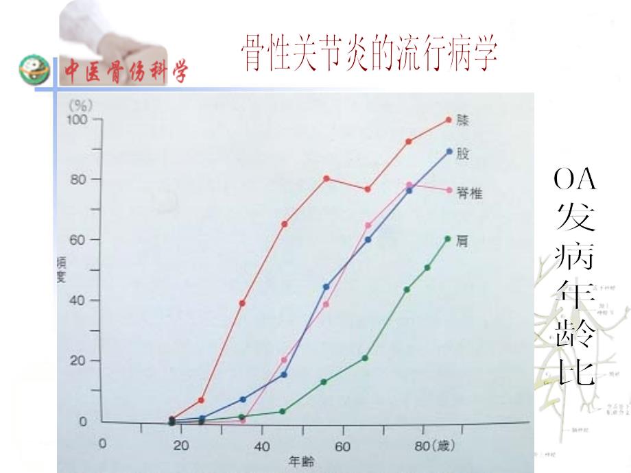 膝骨性关节炎_2_第4页