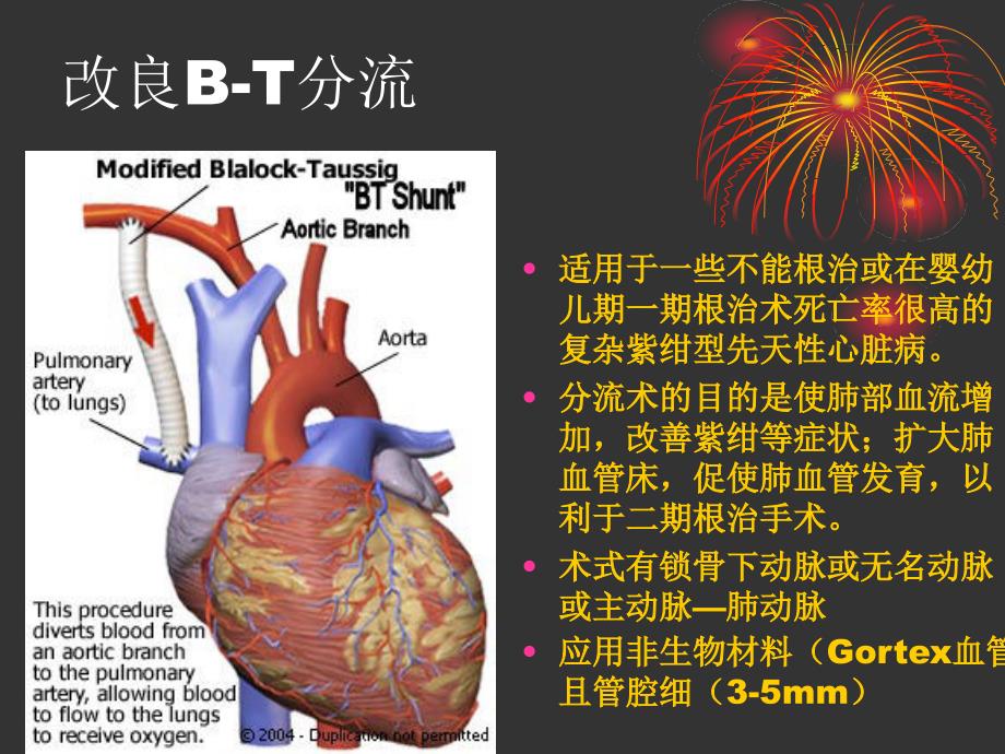 段雷雷-姑息手术抗凝治疗_第4页