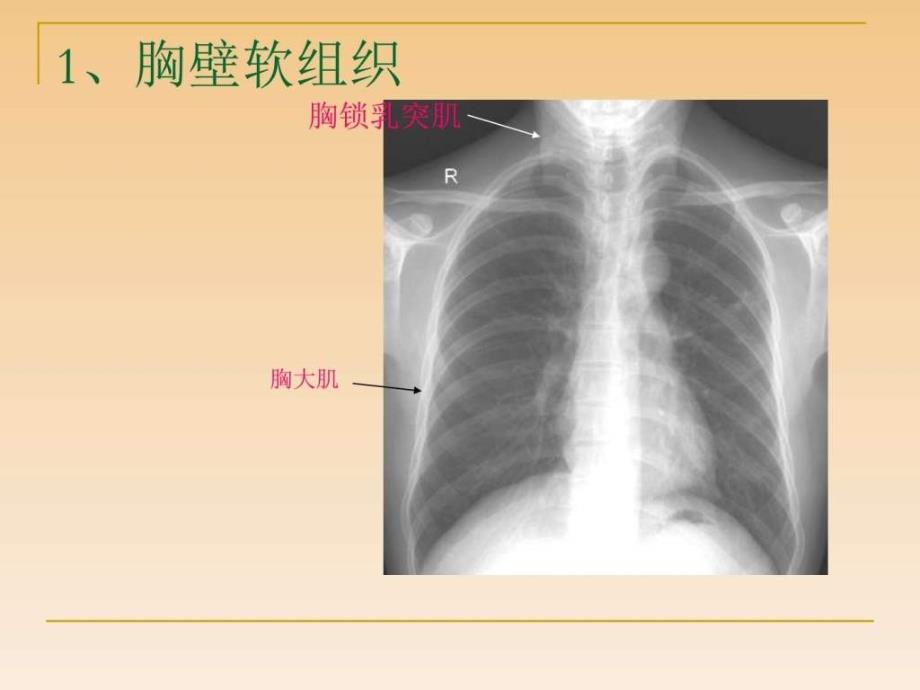 影像学带教(x线ct全够用)_第4页