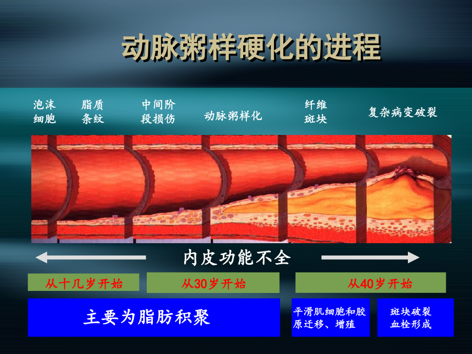 《内科学》课件冠心病_第3页