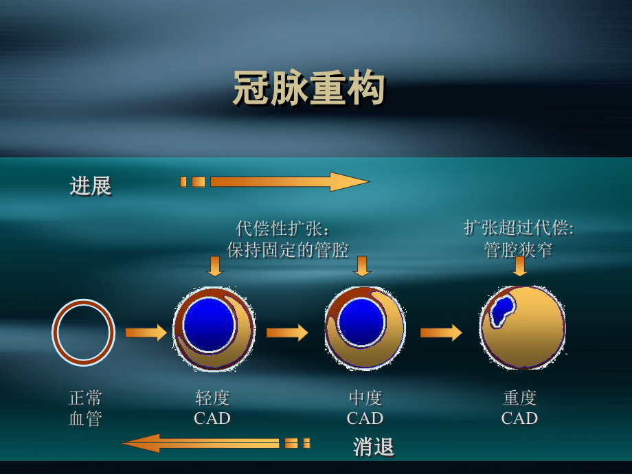 《内科学》课件冠心病_第4页