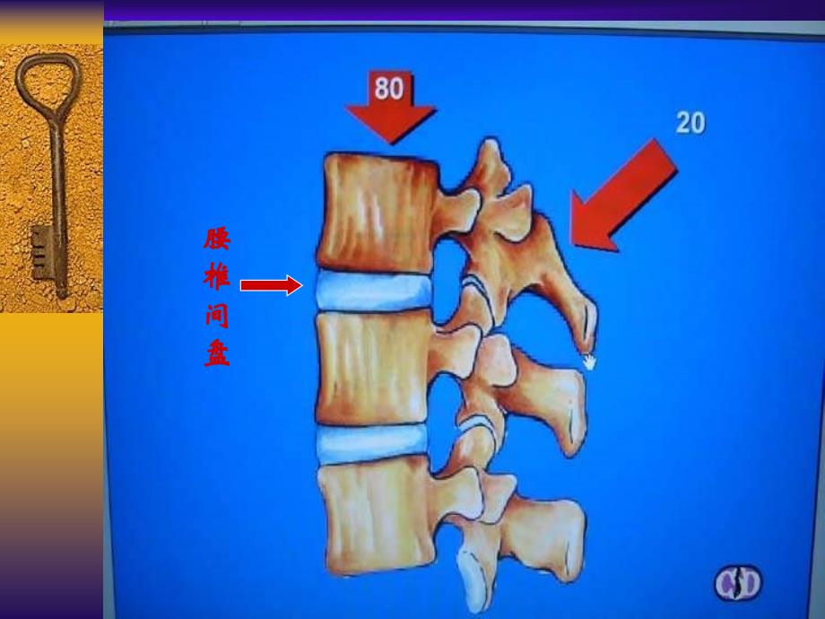 骨科课件-腰腿痛及椎间盘突出症_第2页